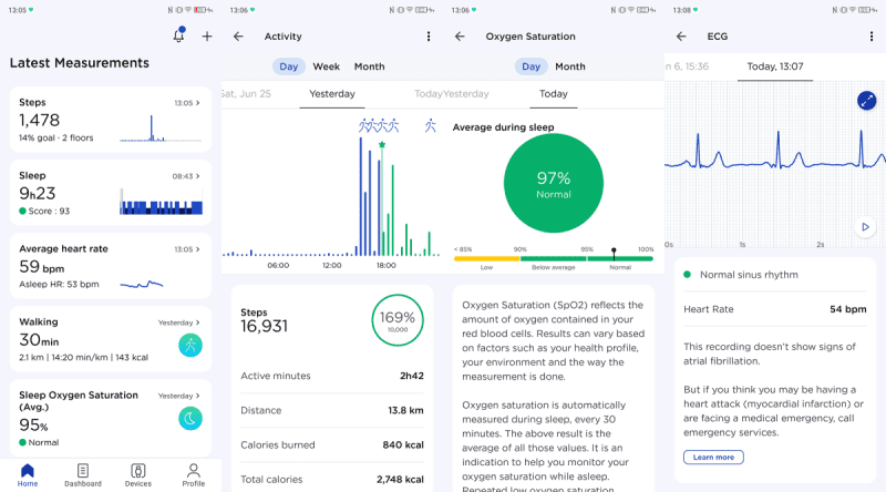 Withings ScanWatch Horizon