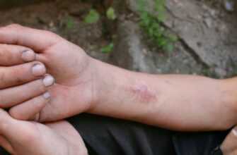 Глобальна Проблема Наркотиків Продовжує Посилюватись На Тлі «Психоделічного Ренесансу» Та Рекордного Обсягу Виробництва Кокаїну. 5