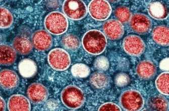 Вооз Б'Є На Сполох У Зв'Язку З Безпрецедентним Зростанням Числа Випадків Захворювання На Віспу Обезьян В Африці 4